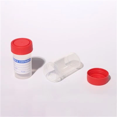 Vizelettartály piros csavaros kupakkal 40ml 60ml 120ml